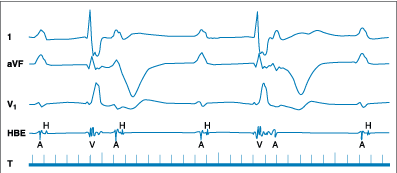 Figure 229-8