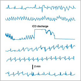 Figure 230-16