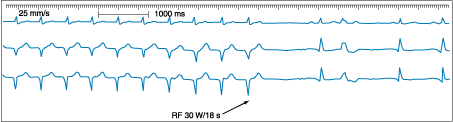 Figure 230-17